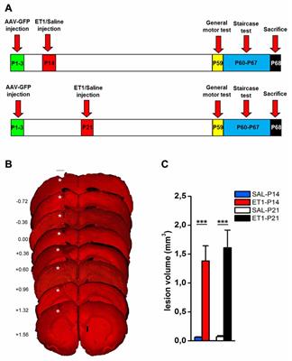 Focal Stroke in the Developing Rat Motor Cortex Induces Age- and Experience-Dependent Maladaptive Plasticity of Corticospinal System